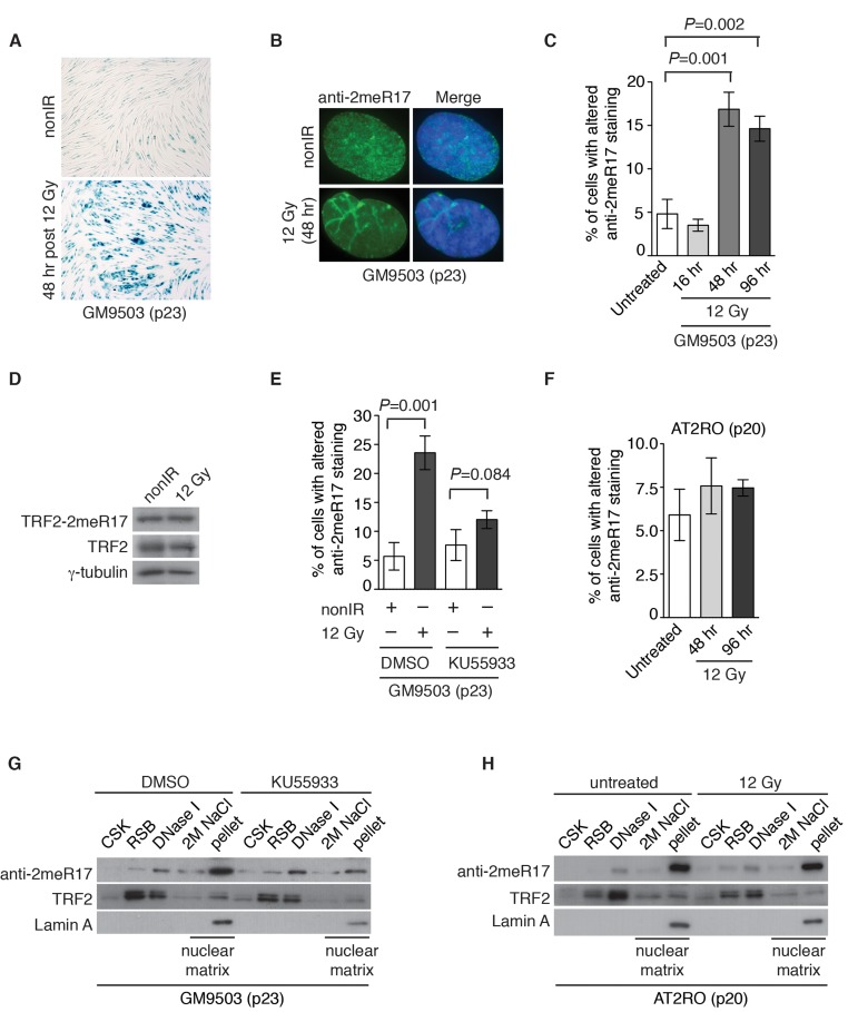 Ionizing radiation induces altered nuclear staining of methylated TRF2 in a ATM-dependent manner. (A) Ionizing radiation induces cellular senescence in GM9503 cells. GM9503 (p23) cells were treated with 12 Gy IR. Senescence-associated β-galactosidase assays were performed 48 h post IR. (B) Indirect immunofluorescence with anti-TRF2-2meR17 antibody in mock- or IR-treated GM9503 cells (p23). Cell nuclei were stained with DAPI in blue. (C) Quantification of percentage of cells with altered nuclear staining of methylated TRF2. A total of 1000 cells in triplicate were scored in blind for untreated or IR-treated cells fixed at various time points post IR as indicated. Standard deviations from three independent experiments are indicated. (D) Western analysis of GM9503 cells (p23) that were either mock- or IR-treated. Immunoblotting was performed with anti-TRF2-2meR17 or anti-TRF2 antibody. The γ-tubulin blot was used as a loading control. (E) ATM inhibition abrogates IR-induced altered nuclear staining of methylated TRF2. GM9503 cells (p23) were treated with DMSO or KU55933 prior to 12 Gy IR treatment. Forty-eight hours post IR, cells were processed for indirect immunofluorescence with anti-TRF2-2meR17 antibody. Quantification of percentage of cells with altered nuclear staining of methylated TRF2. A total of 1000 cells in triplicate were scored in blind. Standard deviations from three independent experiments are indicated. (F) Little IR-induced altered nuclear staining of methylated TRF2 is observed in AT2RO cells lacking functional ATM. Quantification of percentage of cells with altered nuclear staining of methylated TRF2. A total of 1000 cells in triplicate were scored in blind. Standard deviations from three independent experiments are indicated. (G) Sequential extraction of the nuclear matrix from GM9503 cells treated with either DMSO or KU55933. Immunoblotting was performed with anti-TRF2-2meR17, anti-TRF2 or anti-Lamin A antibody. (H) Sequential extraction of the nuclear matrix from AT2RO cells that were either untreated or treated with 12 Gy IR. Immunoblotting was performed with anti-TRF2-2meR17, anti-TRF2 or anti-Lamin A antibody.