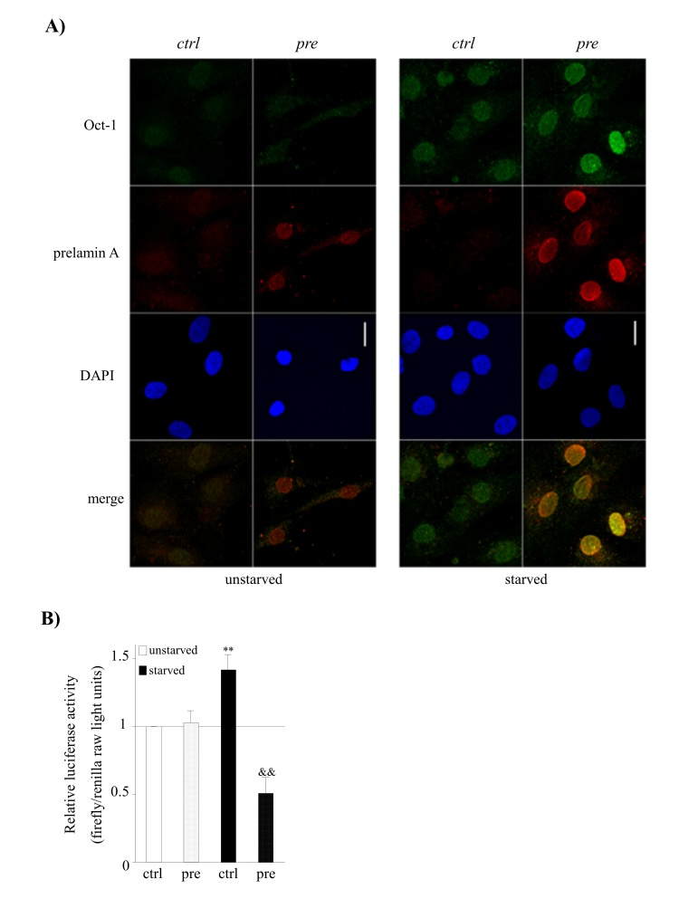 Prelamin A accumulation and serum starvation conditions induce the overexpression of Oct-1 and its impaired activity in hMSCs. (A) Representative confocal immunofluorescence staining showing the expression of Oct-1 and prelamin A in hMSCs under basal (unstarved) or serum starvation conditions (starved). Scale bar: 20 μm. (B) Luciferase reporter assays of Oct-1 transcription factor activity in hMSCs cultured under under basal (unstarved) or serum starvation conditions (starved). Bars are average +/- standard deviation of 3 independent donors. Differences that are significant are marked as follows: ** p