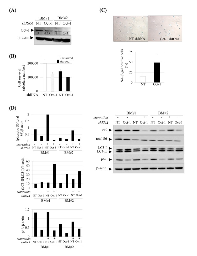 Induction of senescence and autophagy in Oct-1 silenced hMSCs. (A) Western blot showing decreased Oct-1 expression after Oct-1 shRNA plasmids transduction in hMSCs, NT: Non Targeting shRNA. Numbers show densitometric quantification for Oct-1 expression. (B) Cell survival after Oct-1 silencing in hMSCs cultured under basal (unstarved) or serum starvation conditions (starved). (C) Representative SA β-gal staining (left) and quantification (right) in hMSCs transduced with NT or Oct-1 shRNA. Scale bar: 100 μm. (D) Western blot of indicated proteins from hMSCs silenced for Oct-1 or not (NT). β-actin was used as loading control. Densitometry for each immunoblot is provided.For these experiments hMSCs from two independent donors were used(BM≠1 and BM≠2). Bars are mean +/- standard deviation