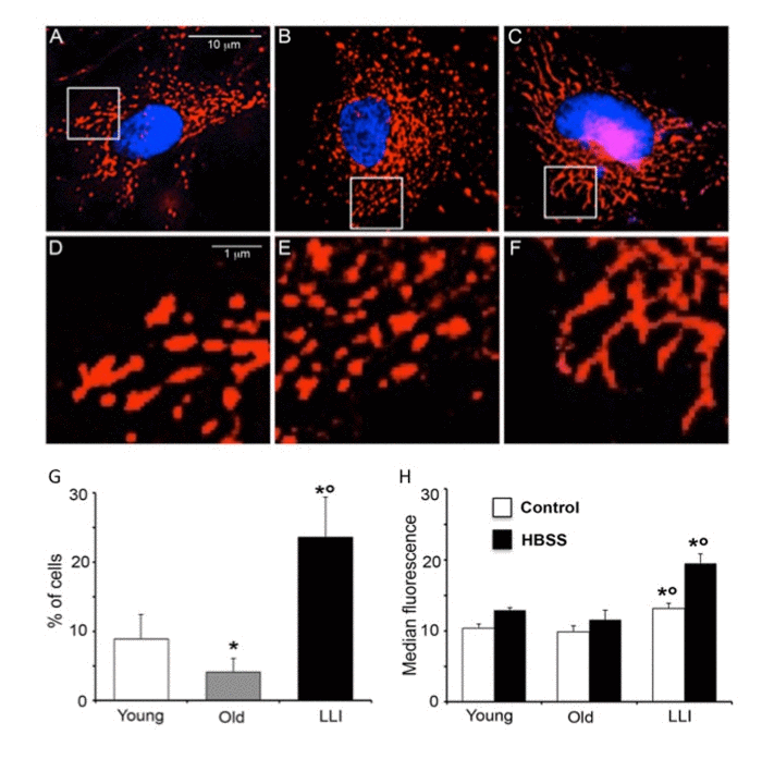 Hyperfused mitochondria are present in DFs from LLI