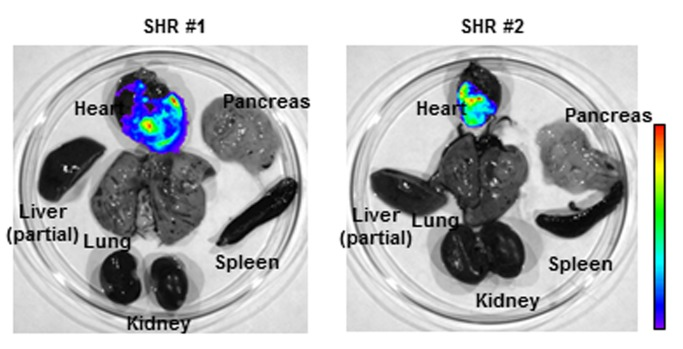 AAV9 vector facilitates long-term cardiac gene delivery in spontaneously hypertensive rats (SHR). Distribution of luciferase activities in SHR organs was monitored by Xenogen IVIS Living Image 18 months after systemic adeno-associated virus (AAV) vector administration. Strong luciferase expression in heart demonstrated efficient long-term cardiac gene delivery by AAV9 vector in SHR.