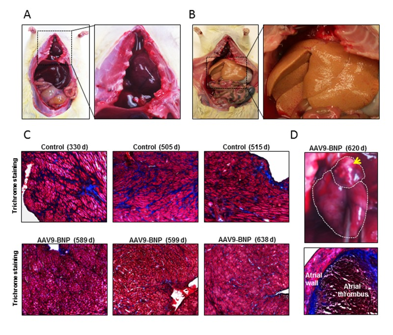 Pathological assessment after long-term proBNP over-expression in aged spontaneously hypertensive rats (SHRs) with established HHD