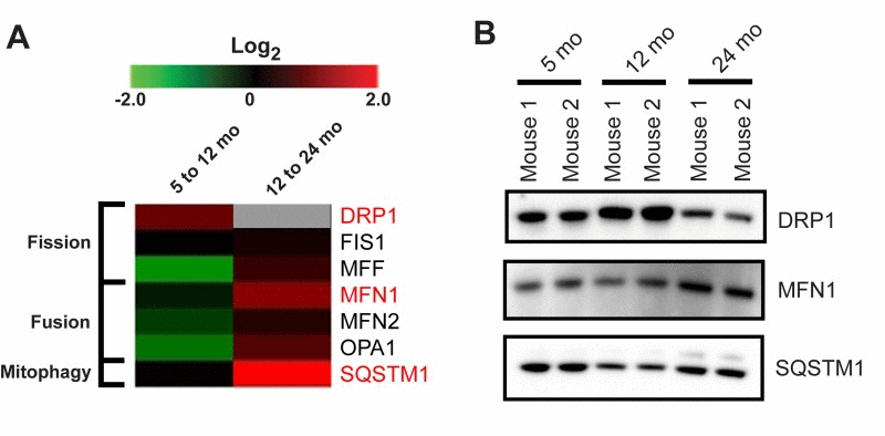 Proteomic changes suggest alterations in mitochondrial dynamics and mitophagy with age