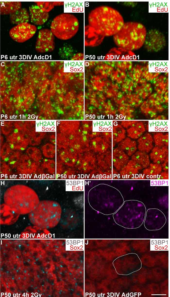 Utricular supporting cells show γH2AX and 53BP1 foci upon forced cell cycle re-entry, as revealed by confocal imaging. (A,B) At 3 DIV, AdcD1-infected P6 and P50 utricles display EdU+ SCs with numerous, small γH2AX foci. (C,D) Similar γH2AX profiles are seen 1 h post-irradiation in Sox2+ utricular SCs of both ages. (E-G) At 3 DIV, Sox2+ SCs in both AdβGal-infected P6 and P50 utricles, and in non-infected P6 utricle show one or two large γH2AX foci per nucleus. (H,H') At 3 DIV, EdU+ SCs in AdcD1-infected P50 utricle display 53BP1 foci. Edu+ SC nuclei containing 53BP1 foci are outlined (H'). (I) Four hours post-irradiation, P50 utricular Sox2+ SCs show 53BP1 foci. (J) At 3 DIV, AdGFP-infected P50 utricle is devoid of 53BP1 foci. A Sox2+/GFP+/53BP1- nucleus is outlined. Abbreviations: AdcD1, adenovirus encoding cyclin D1; AdβGal, adenovirus encoding β-galactosidase; AdGFP, adenovirus encoding green fluorescent protein; Gy, gray; γH2AX, Ser 139 phosphorylated histone H2AX; utr, utricle. Scale bar, shown in J: A-J, 5 µm.