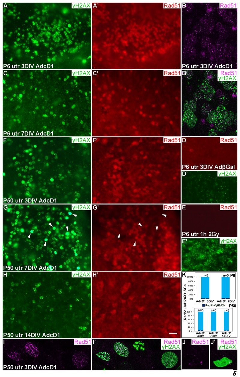 Dynamics of the DNA repair protein Rad51 in cell cycle reactivated supporting cells. Adenovirus-infected utricular explants were maintained for 3 to 14 DIV and double-labeled for γH2AX and Rad51. Imaging by conventional (A,A',C-H') and confocal microscopy (B,B',I-J'). (A,A') At 3 DIV, AdcD1-infected P6 utricle shows Rad51 upregulation in SCs with γH2AX foci. (B,B') High magnification view of an AdcD1-infected P6 utricle showing Rad51 expression as small foci that partially colocalize with the γH2AX foci. (C,C') By 7 DIV, the reduction in Rad51 levels is paralleled by γH2AX resolution. (D,D') AdβGal-infected P6 utricle lacks Rad51 expression. (E,E') P6 utricle exposed to ionizing radiation and analyzed 1 h post-irradiation contains SCs with DSB-like γH2AX foci. These cells lack Rad51 expression. (F,F') At 3 DIV, also the AdcD1-infected P50 utricle shows Rad51 induction in γH2AX+ SCs. (G,G') Rad51 expression is maintained at 7 DIV. Note that adult SCs with bright, pan-nuclear γH2AX staining lack or show only weak Rad51 expression (arrowheads). (H,H') Rad51 levels are reduced in the adult utricle by 14 DIV, paralleling γH2AX resolution. (I,I') High magnification view shows Rad51 foci in AdcD1-infected adult SCs and that these foci partially colocalize with γH2AX foci. (J,J´) High magnification view shows that adult SCs with pan-nuclear γH2AX staining express only low levels of Rad51. (K) Quantification shows that, at all timepoints studied and both in P6 and P50 utricles, Rad51 expression closely parallels that of γH2AX. Only 3-5% of Rad51+ SCs were negative for γH2AX. Mean ± SEM and the number of explants (n) are shown. Abbreviations: AdcD1, adenovirus encoding cyclin D1; AdβGal, adenovirus encoding β-galactosidase; γH2AX, Ser 139 phosphorylated histone H2AX; utr, utricle. Scale bar, shown in H': A,A',C-H', 20 µm; B,B',I-J', 5 µm.