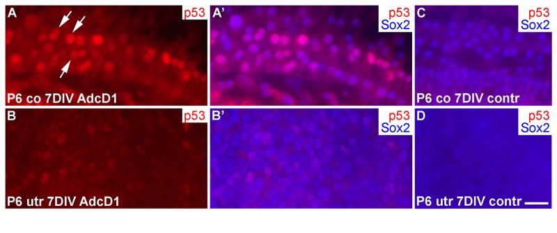 p53 induction in SCs of cochlear explants transduced by AdcD1. (A-B') At 7 DIV, p53 is upregulated in Sox2+ Deiters' cells of P6 cochleas, especially in nuclear doublets and in the large, likely replicating nuclei (arrows). Age-matched utricles show weak or undetectable p53 upregulation. (C,D) In non-infected explants, p53 expression is undetectable. Abbreviations: co, cochlea; AdcD1, adenovirus encoding cyclin D1; utr, utricle. Scale bar, shown in D: A-D, 20 µm.