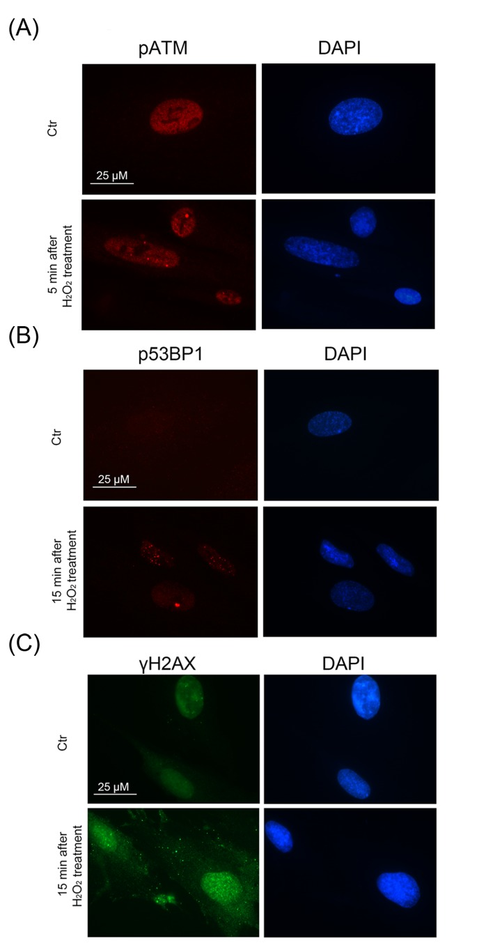 A rapid DDR activation in H2O2-treated hMESCs