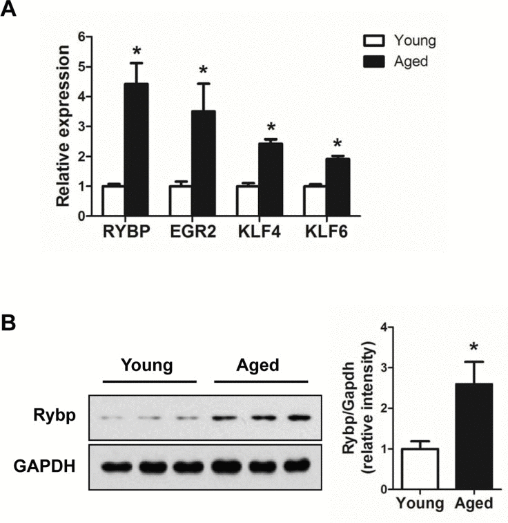 Up-regulation of genes involved in the trans-cription regulation in aged muscle