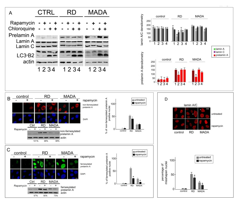 Prelamin A degradation in RD and MADA cells