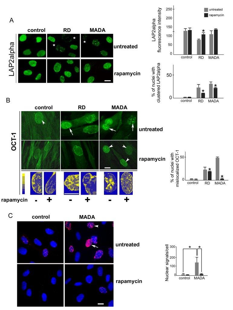 LAP2alpha and Oct-1 localization are affected in MADA and rescued by rapamycin