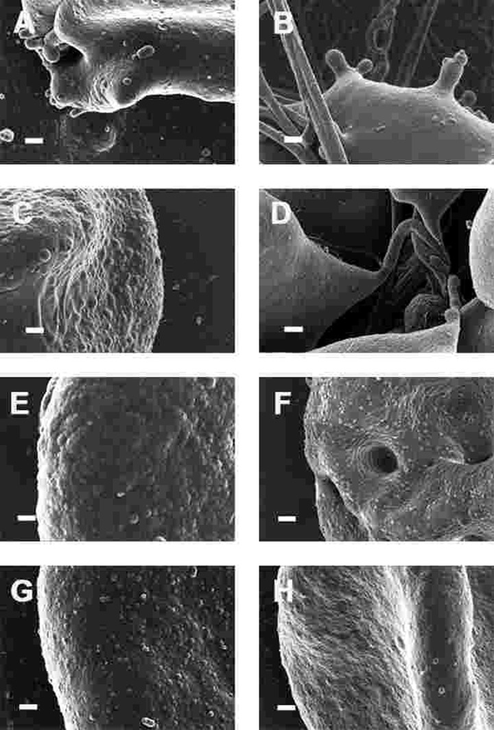 High magnification (100,000x machine magnification) of erythrocyte membranes of Parkinson's disease patients prepared from whole blood. Serum ferritin levels: (A) 194 ng.mL−1 (B) 118 ng.mL−1 (C) 90 ng.mL−1 (D) 21 ng.mL−1 (E) 281 ng.mL−1 (F) 145 ng.mL−1 (G) 372 ng.mL−1 (H) 358 ng.mL−1 Scale bar = 200 nm.