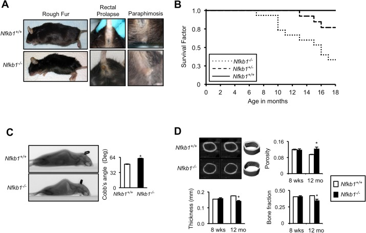 Nfkb1−/− mice have accelerated age-related findings and reduced lifespan