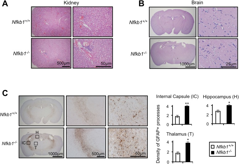 Nfkb1−/− mice exhibit enhanced age-related CNS gliosis