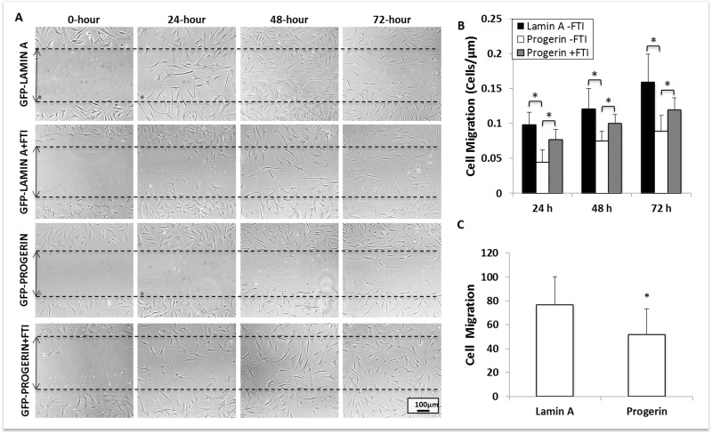 Progerin expression significantly decreases MIAMI cell migration. (A) GFP-lamin A MIAMI and GFP-progerin MIAMI cells were scraped at 0 hrs with a 2mL glass pipette tip. Scraped areas were imaged at 0, 24, 48, and 72 hours, with and without FTI, to monitor cellular migration. (B) Progerin expression significantly decreases migration at 24, 48, and 72 hours. FTI treatment significantly increases migration at 24, 48, and 72 hours when compared to untreated progerin MIAMI cells. (C) Lamin A and Progerin MIAMI cells were plated in MIAMI media containing no FBS in the upper chamber of a transwell. MIAMI media with FBS was placed in the bottom chamber. After 24 hours, cells remaining in the upper chamber were washed away, and cells that migrated to the bottom of the transwell were stained with DAPI and immunofluorescently imaged. Progerin expression significantly decreases migration through the transwell membrane. Values are mean ± standard deviation (n≥3). *pt-test.