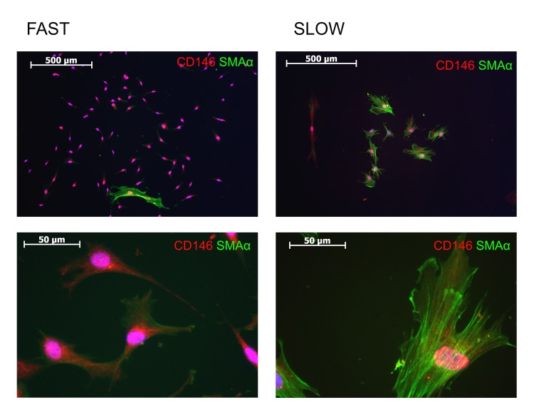 Analysis of expression of CD146 and SMAα in “slow” and “fast” CFU-Fs