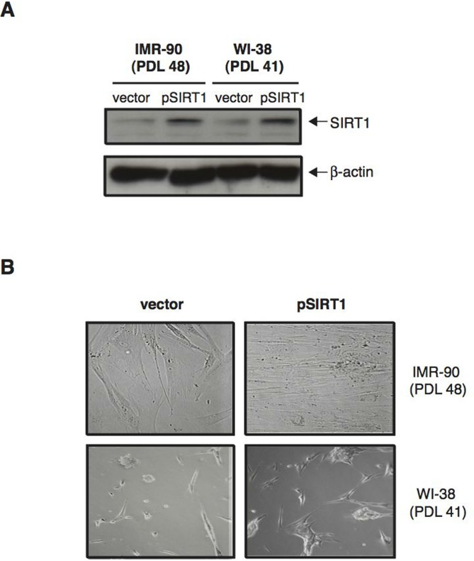 Over-expression of SIRT1 in normal human diploid fibroblasts delays senescence