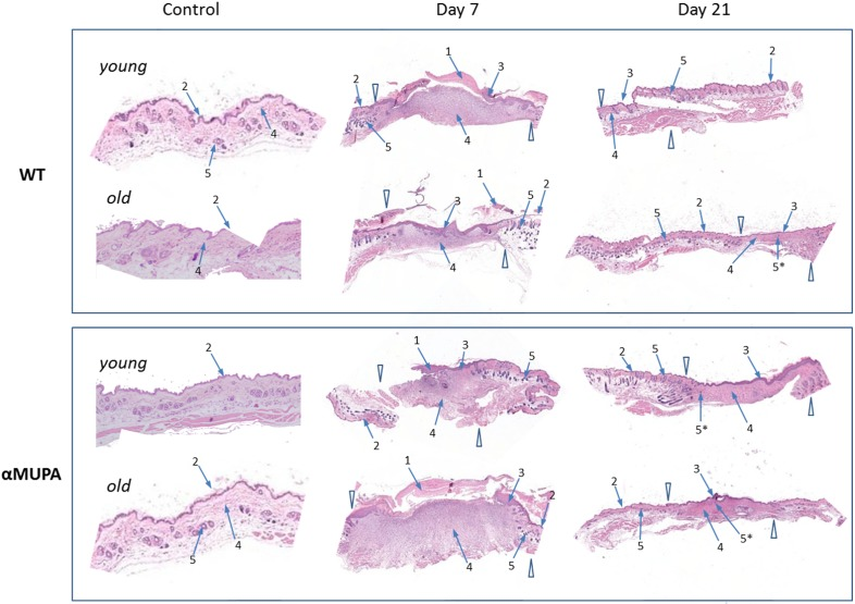 Histological examination of skin wound healing in αMUPA and WT mice