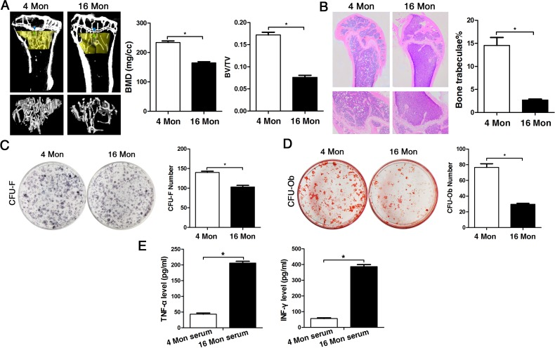 The osteogenic capacity of old mice is significantly reduced both in vivo and in vitro. Statistically analyzed values show the mean ± SD (n=10). * p (A) Micro-CT analysis of trabecular bone mass in the tibiae of 4 (young) and 16 month-old (old) mice. Quantitative analyses were performed via volumetric bone mineral density (BMD) and trabecular bone volume fraction (BV/TV) measurements. (B) HE stainings of histological sections from femur derived from young and old mice for detection of the number of bone trabeculae. (C-D) Representative images of the CFU-F assay for determination of proliferation capacity and of the CFU-Ob assay for osteogenic differentiation ability of BMMSCs obtained from young and old mice and stained with crystal violet and alizarin red, respectively. CFU efficiency was determined by the number of colonies relative to the total number of seeded cells in each plate. (E) Serum levels of TNF-α and INF-γ in young and old mice determined via ELISA. Results are expressed as pg/ml.