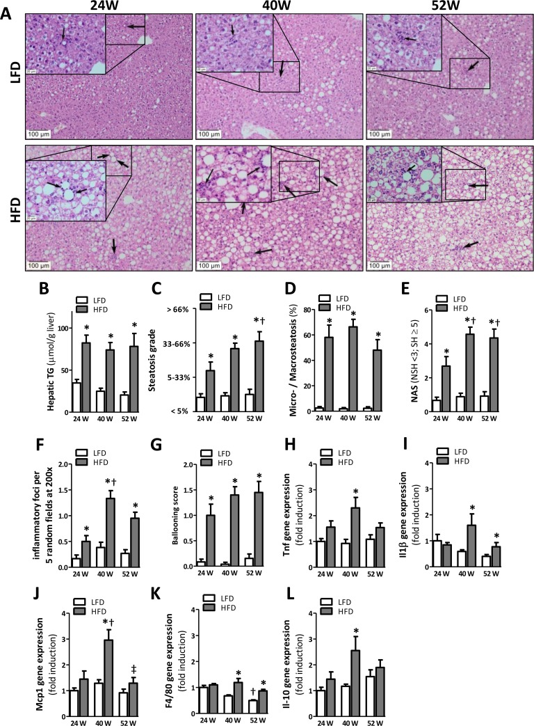 High-fat diet induced obesity primes inflammation in adipose tissue prior  to liver in C57BL/6j mice | Aging