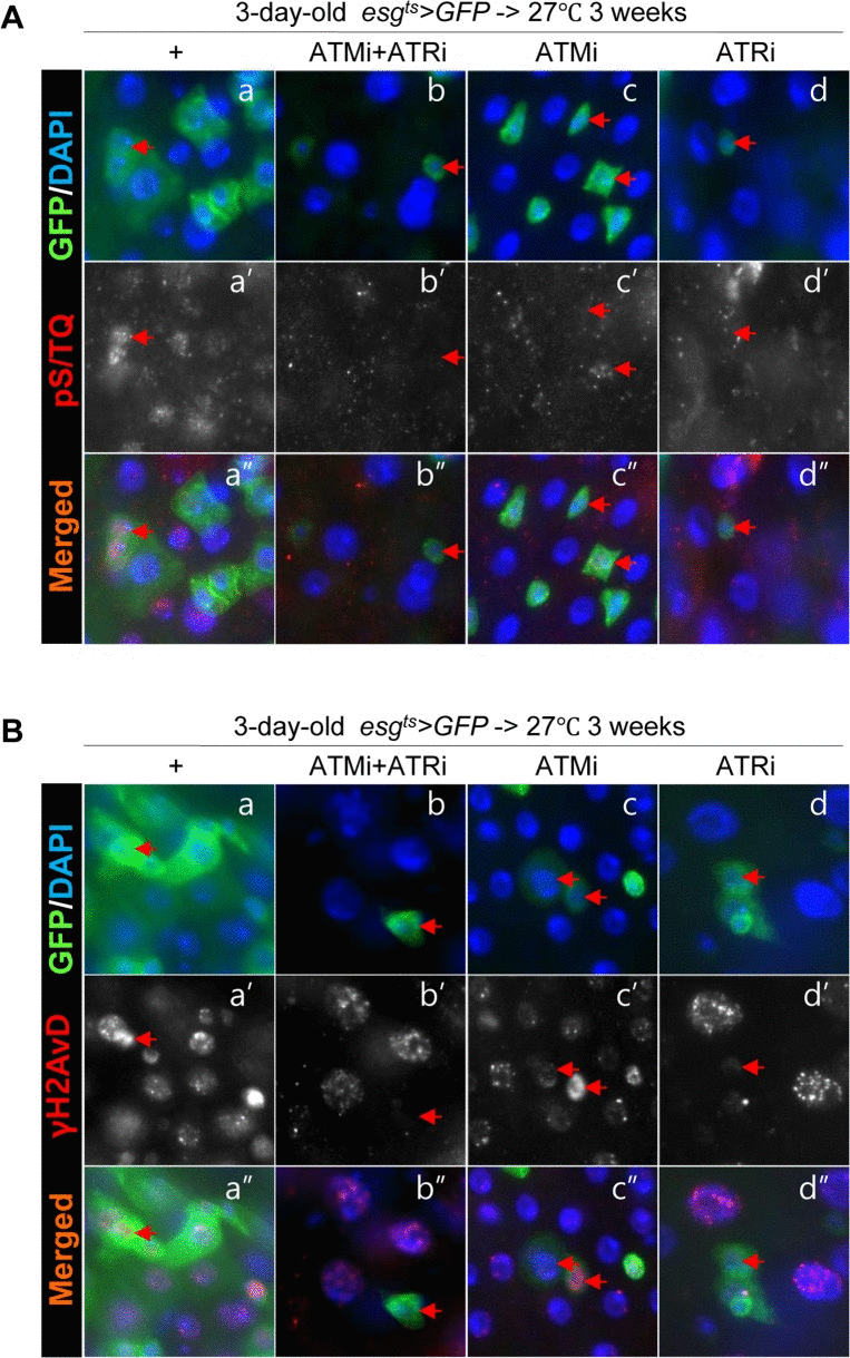 Effects of the intestinal stem cell (ISC)/enteroblast (EB)-specific knockdown of ATM or ATR on activation of the DNA damage response (DDR) with age