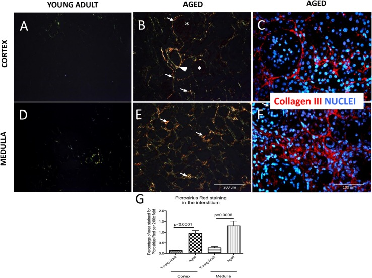 Accumulation of type I and III collagen in aged kidneys