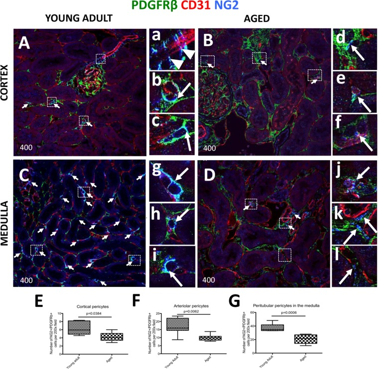 Decreased expression of kidney pericyte markers in aged mice