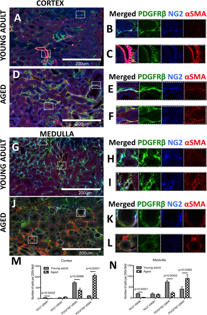 A subset of pericytes differentiate into myofibroblasts and increase in aged kidneys