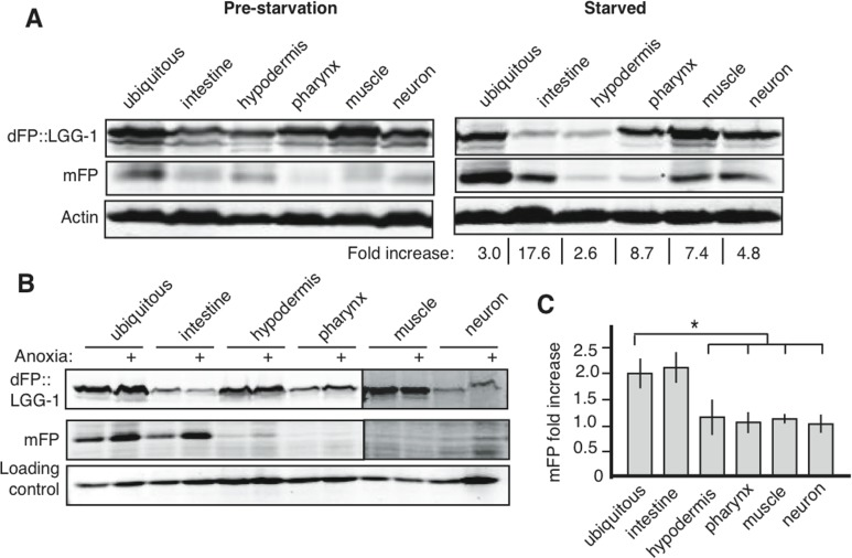 Starvation and anoxia induce different patterns of autophagy upregulation