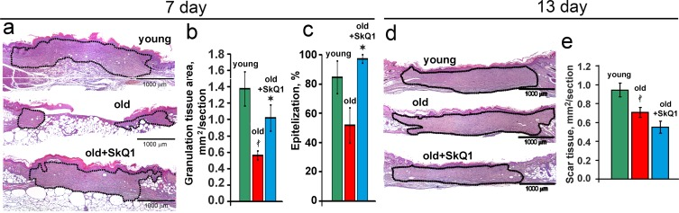 SkQ1 promotes granulation tissue formation and epithelization of old mice wound, but does not cause scar hypertrophy