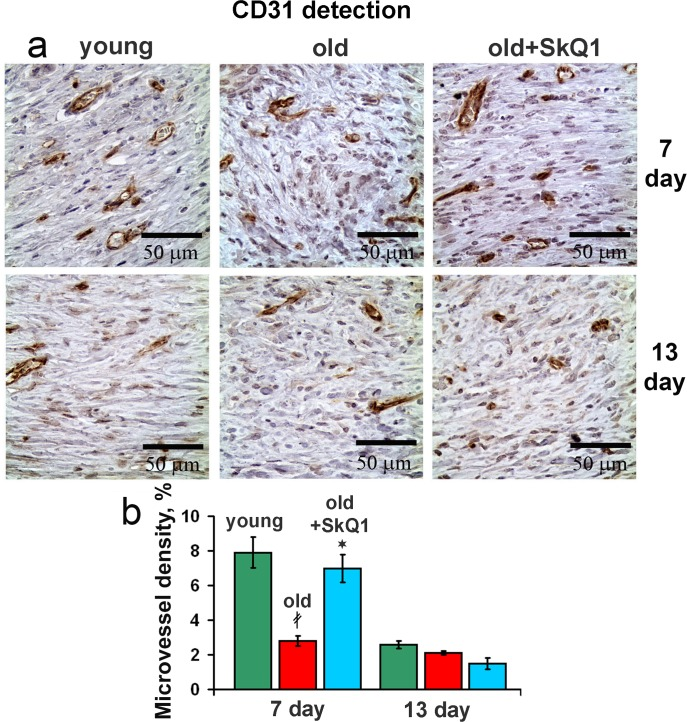 Effect of SkQ1 on the angiogenesis
