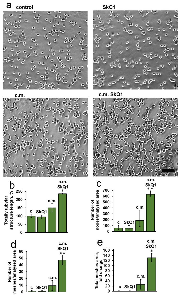 Effect of SkQ1 on endothelial EA.hy926 cell tubular structures formation on Matrigel