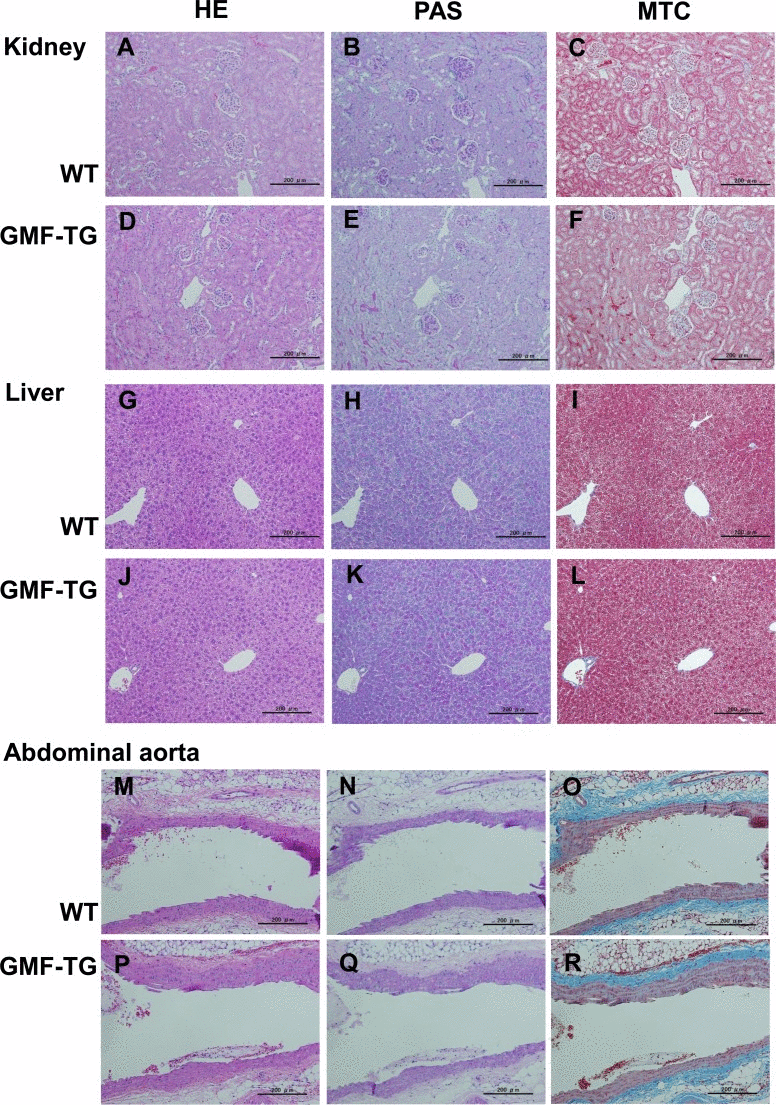 Histological appearance of the kidney, liver and abdominal aorta in WT and GMF-TG mice