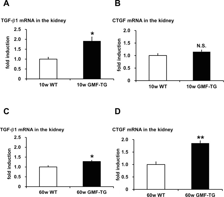 The expression of TGF-β1 and CTGF in WT and GMF-TG mice