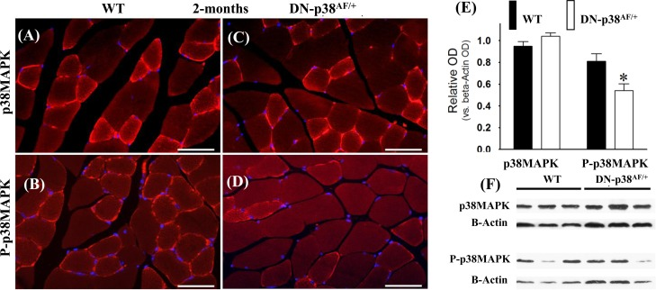 Expression of p38α and phospho-p38α in the gastrocnemius of young (2 mos old) wild type and DN-p38αAF/+ mice
