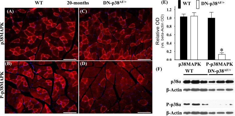 Expression of p38α and P-p38α in the gastrocnemius of aged (20 mos) wild type (WT) and DN-p38αAF/+ mice