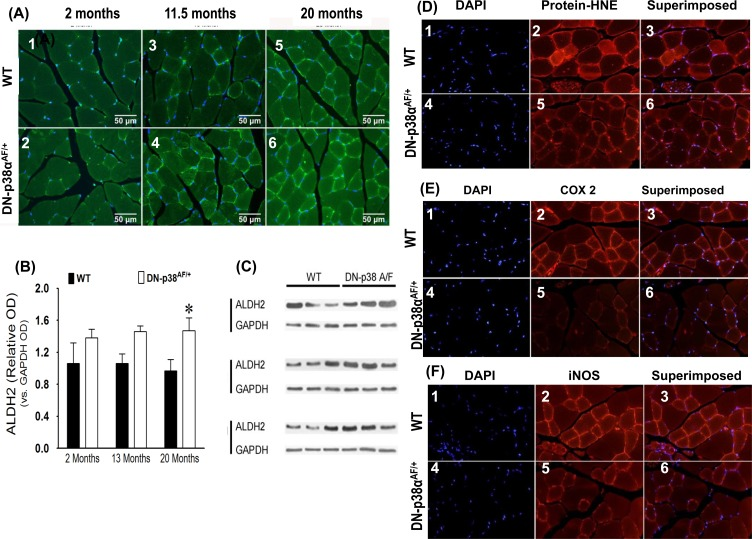 (A-C) Expression levels of ALDH2, a juvenile protective factor, by the gastrocnemius of young (2 mos), middle aged (13.5 mos) and aged (20 mos) WT and DN-p38αAF/+ mice