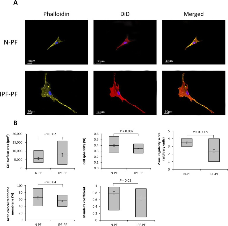 Morphology analysis of lung fibroblasts by Z-stack confocal microscopy