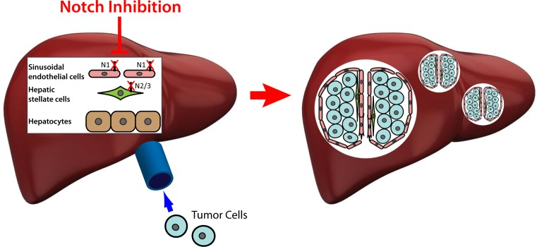 Notch inhibition activates sinusoidal endothelial cells and hepatic stellate cells to promote hepatic metastases.