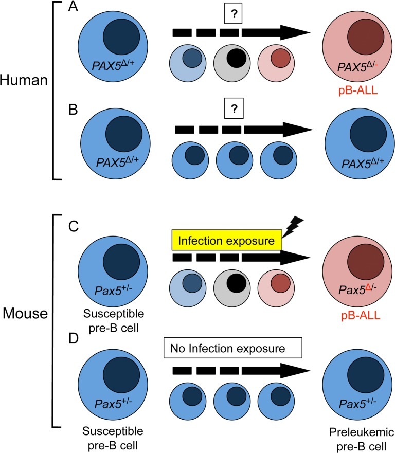 Exposure to infection is a causal factor in B-precursor acute lymphoblastic leukemia as a result of Pax5 inherited susceptibility