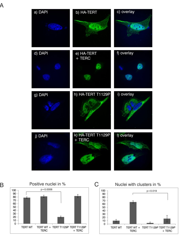 Analysis of nuclear clustering of the TERT T1129P mutation in a cell culture model