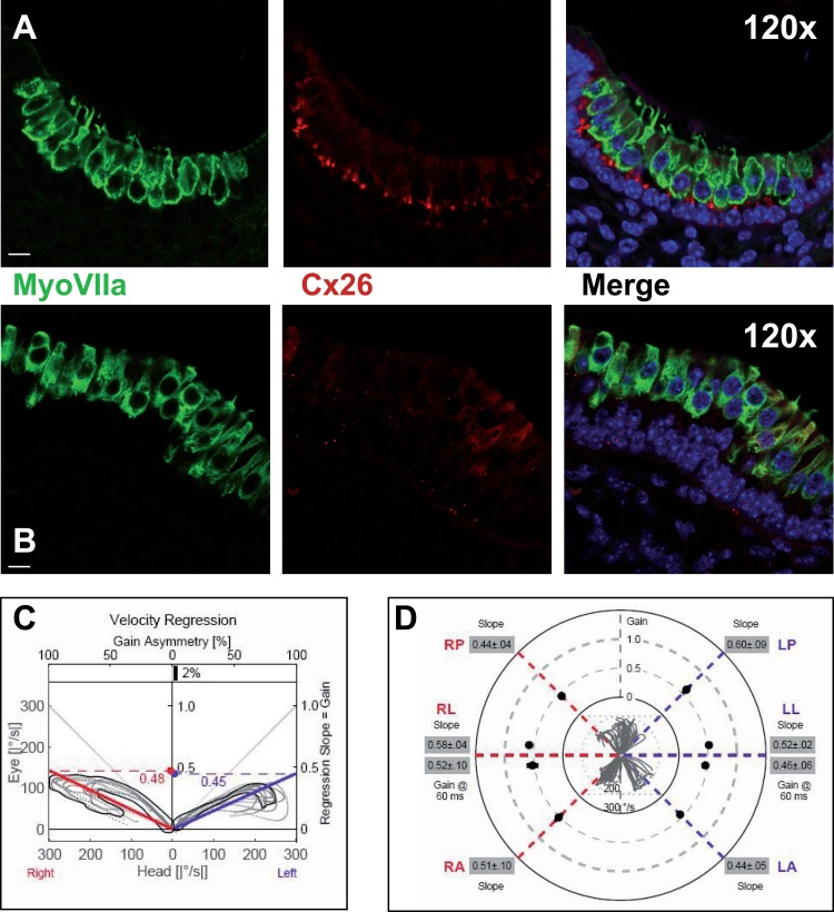 Macular structure in p63 defective mice and vestibular function in EEC patient
