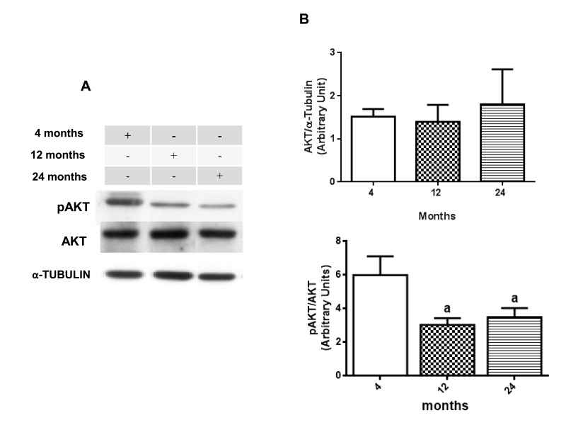 Changes in the pAKT/AKT ratio in hippocampus of 4-, 12- and 24-month-old rats