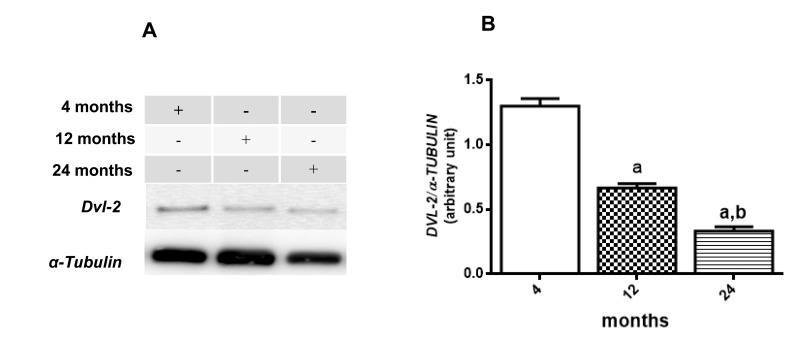 Changes in the DVL-2 levels in hippocampus of 4-, 12- and 24-month-old rats