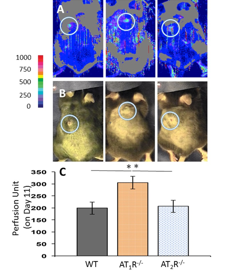 Laser Doppler perfusion imaging of wound area blood flow on day 11 of wound healing shows a higher blood flow in wounds of AT1R−/−. Data are means ± SEM *p