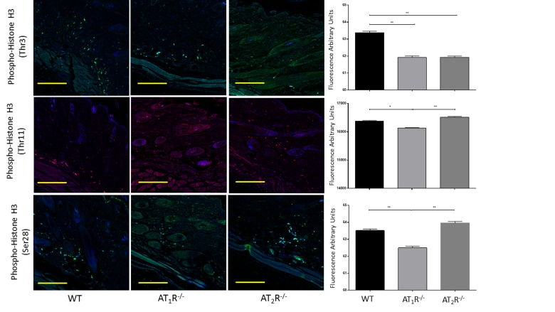 Down regulation of mitotic histone H3 phosphorylation in wounds of AT1R−/− at several residues, including serine 28 as well as threonine 3 and 11. AT2 R−/− mice have lower expression of Phospho-Histone H3 (Thr3) in healed skin (day20) as compared to WT. The photomicrographs presented in green (Thr3 and S28) or red (Thr11) fluorescent staining with a blue DAPI counter stain for nuclei at 10x magnification. Quantification of mean fluorescence intensity of Phospho-Histone H3 in wild-type and mutant mice is shown. Scale bar 200 μm. *p