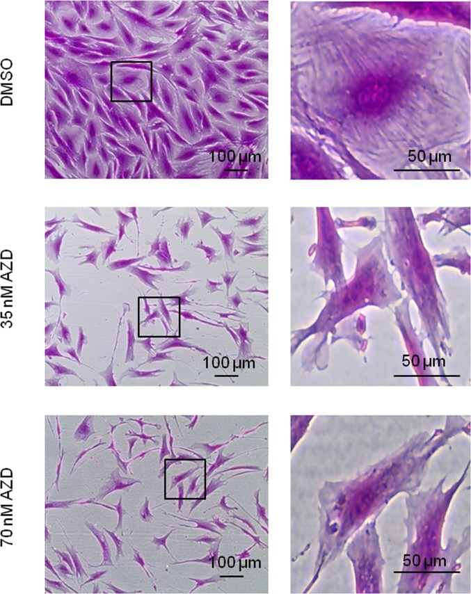 Loss of filamentous structures in AZD8055-treated cells