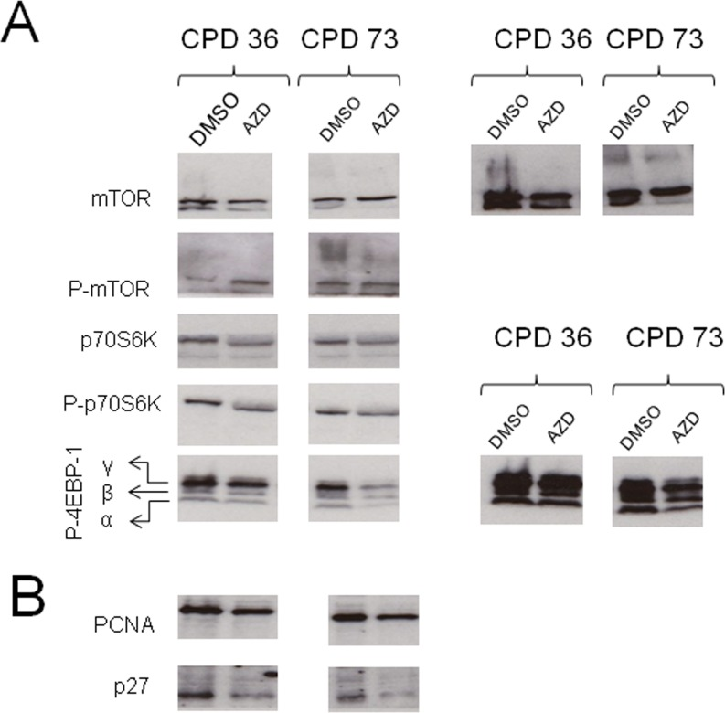 Alteration in protein levels and phosphorylation on short term AZD8055 treatment