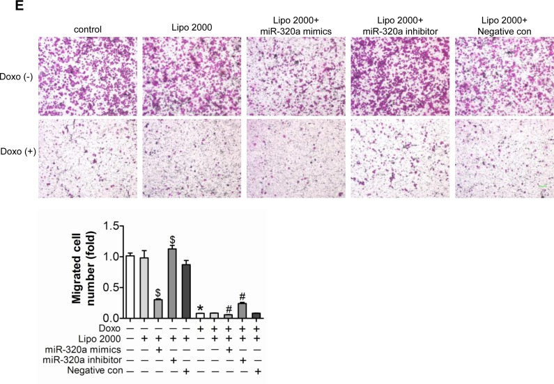 Inhibition of miR-320a improved doxorubicin induced endothelial cells impairment in vitro
