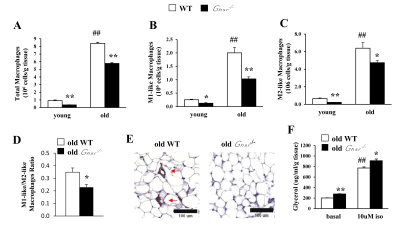 GHS-R ablation reduces macrophage infiltration into WAT, decreases pro-inflammatory M1-like macrophages and reduces M1/M2 macrophage ratio in WAT of old mice