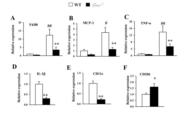 GHS-R ablation decreases age-associated increases of inflammation in BAT